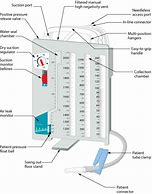 Image result for Chest Tube Device