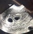 Image result for 5 Weeks Pregnant Ultrasound Twins