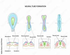 Image result for Neural Tube Formation