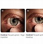 Image result for Putting in Contact Lenses