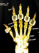 Image result for NBA Rings