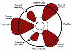 immagini emorroidi interne cosa sono le emorroidi cause sintomi e come eliminarle immagini emorroidi interne cosa sono le emorroidi cause sintomi e come eliminarle