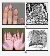 Image result for Altered Fingerprints
