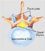 Image result for inrervertebral