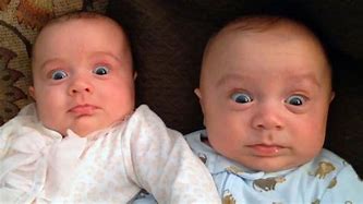 Image result for Ugly Twin Babies