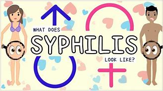 Image result for Syphilis Animation