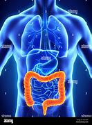 Image result for Colon Polyps Anatomy