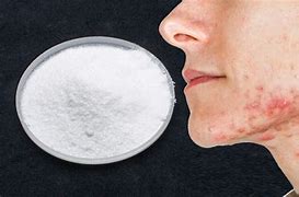 Image result for Boric Acid Cream On Skin