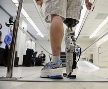 Image result for Bionic Prosthetic Leg