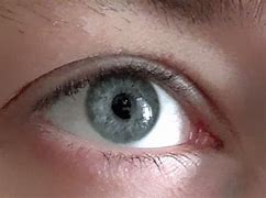 Image result for Pupillary Distance