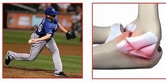 Image result for Injured Arm Baseball Pitcher