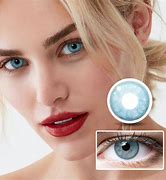 Image result for Astigmatism Contacts for Light Eyes