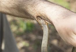 Image result for Biggest Snake Bite