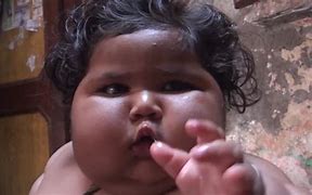 Image result for Obese Baby Girl