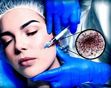 Image result for Liquid Silicone Injections