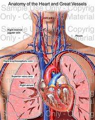 Image result for Ischemic Heart