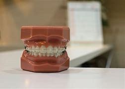 Image result for Dental Wallpaper 4K