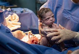 Image result for Birth of a Human Baby