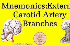 Image result for Carotid Pulse