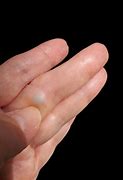 Image result for Finger Vein Recognition