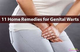 Image result for Treatment for Genital Warts