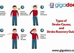 Image result for Minor Stroke Recovery
