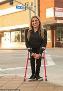 Image result for Person with Spina Bifida