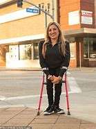 Image result for Spina Bifida in Adult Women