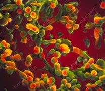 Image result for Chlamydia Microscope