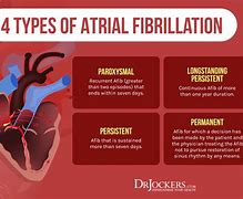 Image result for What Causes Atrial Fibrillation