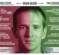 Image result for Recovery From Brain Damage