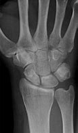 Image result for Wrist Bone Anatomy X-ray
