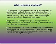 Image result for Signs of Scabies