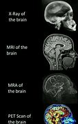Image result for Brain Scan Small Brain Meme