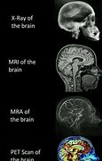 Image result for Brain Scan Meme