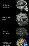 Image result for Brain Scan Funny