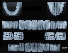 Image result for FMX X-ray