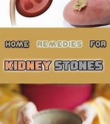 Image result for When Does a Kidney Stone Look Like