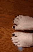Image result for Toe Spacers for Feet
