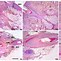 Image result for Mesenchymal Stem Cells and Androgentie Alopecia