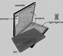 Image result for Lanex Screen Radiography