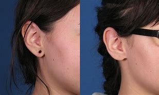 Image result for 2 Gauge Ear