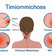 Image result for Trichomoniasis Slide