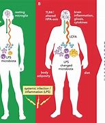 Image result for Obesity Inflammation