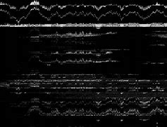 Image result for Black and White Glitch Backround
