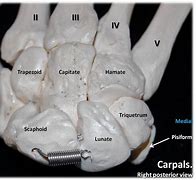 Image result for Hand Carpal Bones Mnemonic