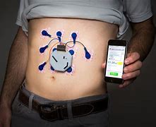 Image result for Wearable Heart Monitor Stomach