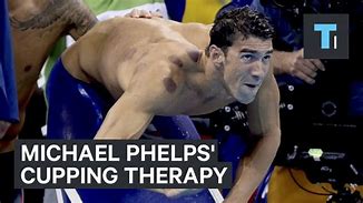 Image result for Michael Phelps Cupping