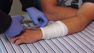 Image result for Bandage Scissors Uses