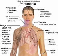 Image result for Life Cycle of Pneumonia